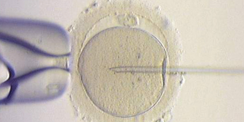Eine Mikroskopaufnahme von einer intrazytoplasmatischen Spermieninjektion.