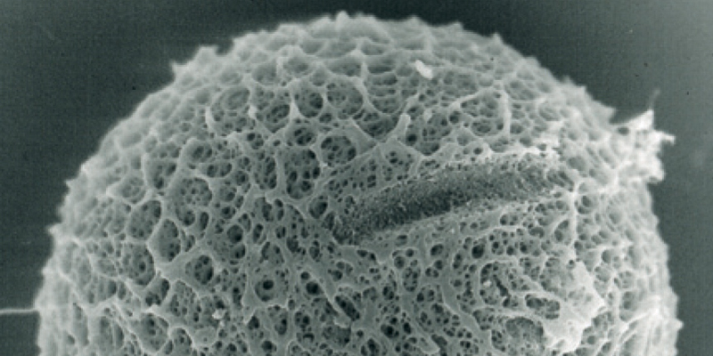 Mikroskopaufnahme einer Eizelle, deren Hülle durch Laser Assisted Hatching ausgedünnt wurde.
