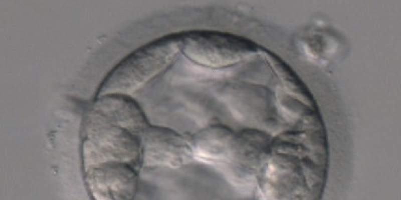 Eine Mikroskopaufnahme einer Blastozystenkultur.